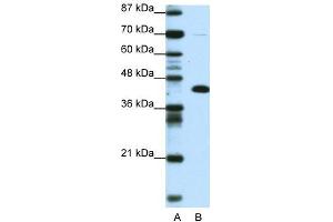 Transfected 293T; WB Suggested Anti-ZBTB25 Antibody Titration: 0. (ZBTB25 antibody  (Middle Region))