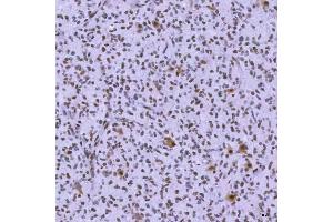 IHC analysis of SNRNP200 using anti-SNRNP200 antibody (ABIN7602032). (SNRNP200 antibody  (AA 557-2129))