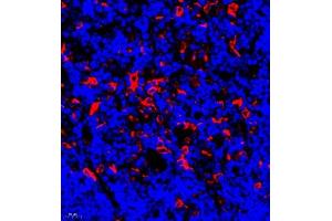 Immunofluorescence (Paraffin-embedded Sections) (IF (p)) image for anti-HLA-DR-gamma (CD74) antibody (ABIN7074245)