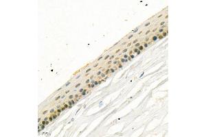 Immunohistochemistry of paraffin embedded rat eye using SLC7A14 (ABIN7075683) at dilution of 1:700 (400x lens) (SLC7A14 antibody)