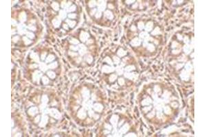 Immunohistochemistry of TEM2 in human colon tissue with this product at 2. (RASD2 antibody  (N-Term))