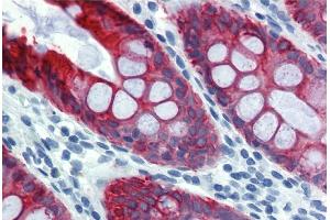 Immunohistochemistry staining of human colon (paraffin sections) using anti-cytokeratin 18 (clone DA-7). (Cytokeratin 18 antibody)