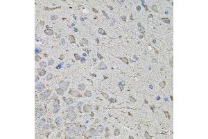 Immunohistochemistry of paraffin-embedded mouse brain using CDK10 antibody. (CDK10 antibody  (AA 1-283))