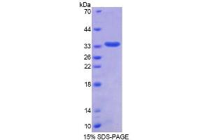 SDS-PAGE (SDS) image for Thymopoietin (TMPO) (AA 1-243) protein (His tag) (ABIN6237812) (Thymopoietin Protein (TMPO) (AA 1-243) (His tag))