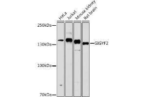 Western blot analysis of extracts of various cell lines, using GIGYF2 antibody (ABIN6132175, ABIN6141083, ABIN6141084 and ABIN6215640) at 1:1000 dilution. (GIGYF2 antibody  (AA 350-500))