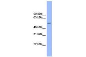 Image no. 1 for anti-Colony Stimulating Factor 1 (Macrophage) (CSF1) (AA 215-264) antibody (ABIN6743293) (M-CSF/CSF1 antibody  (AA 215-264))