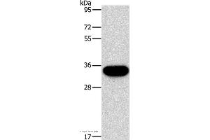 Western blot analysis of PC3 cell, using HOXB13 Polyclonal Antibody at dilution of 1:900 (HOXB13 antibody)