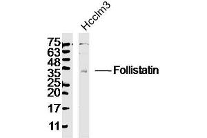 Lane 1: HCCLM3 lysates, probed with Follistatin Polyclonal Antibody, Unconjugated  at 1:300 dilution and 4˚Covernight incubation. (Follistatin antibody  (AA 151-250))
