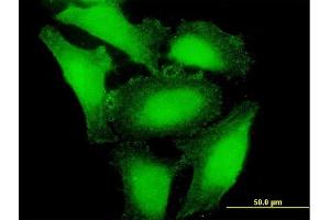 Immunofluorescence of purified MaxPab antibody to APOBEC3H on HeLa cell. (APOBEC3H antibody  (AA 1-182))