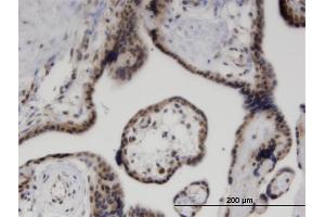 Immunoperoxidase of monoclonal antibody to ZNF232 on formalin-fixed paraffin-embedded human placenta. (ZNF232 antibody  (AA 181-280))
