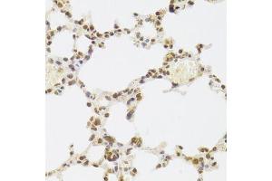 Immunohistochemistry (Paraffin-embedded Sections) (IHC (p)) image for anti-X-Ray Repair Complementing Defective Repair in Chinese Hamster Cells 6 (XRCC6) (AA 500-600) antibody (ABIN1513143)