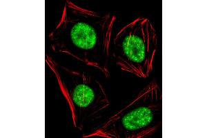 Immunofluorescent analysis of 4 % paraformaldehyde-fixed, 0. (RBBP5 antibody  (C-Term))