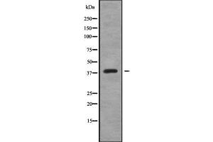 Western blot analysis of CREB3L4 using K562 whole cell lysates