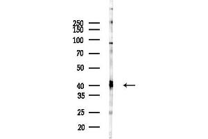 anti-ST3 beta-Galactoside alpha-2,3-Sialyltransferase 1 (ST3GAL1) antibody