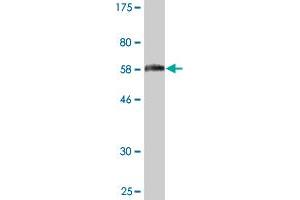 Western Blot detection against Immunogen (60. (AKR1B1 antibody  (AA 1-316))