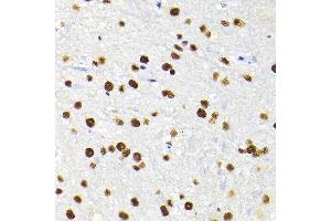 Immunohistochemistry (IHC) image for anti-Tripartite Motif Containing 28 (TRIM28) (AA 576-835) antibody (ABIN1683037)