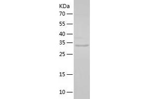 Western Blotting (WB) image for Spermidine Synthase (SRM) (AA 1-302) protein (His tag) (ABIN7285569) (Spermidine Synthase Protein (SRM) (AA 1-302) (His tag))