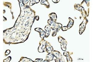 IHC analysis of BCKDK using anti-BCKDK antibody (ABIN7601470).