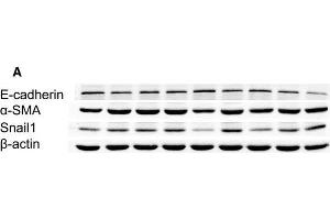 Downregulation of Snail1 reduced high glucose-induced EMT and TGF-β1 secretion in cultured HK2 cells. (SNAIL antibody  (C-Term))