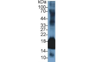 Detection of SOD1 in Rabbit Uterus lysate using Polyclonal Antibody to Superoxide Dismutase 1 (SOD1) (SOD1 antibody  (AA 2-153))