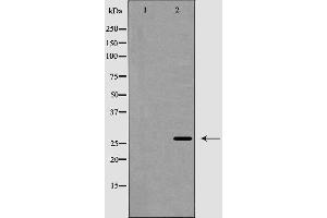 Western blot analysis of TALL-2 expression in COLO205 cells. (TNFSF13 antibody  (Internal Region))