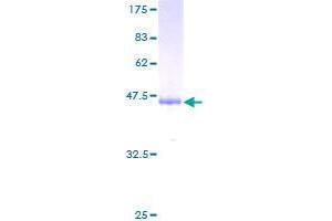 Gastrokine 1 Protein (GKN1) (AA 21-185) (GST tag)