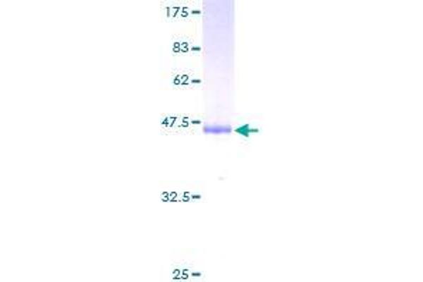 Gastrokine 1 Protein (GKN1) (AA 21-185) (GST tag)