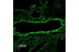 Immunohistochemistry analysis using Rabbit Anti-ENaC Polyclonal Antibody . (SCNN1A antibody  (AA 629-650))