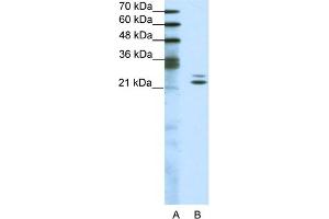 WB Suggested Anti-BUD31 Antibody Titration:  1. (BUD31 antibody  (Middle Region))