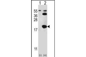 Western blot analysis of UBE2I (arrow) using rabbit polyclonal UBE2I Antibody (S7) (ABIN387910 and ABIN2844306). (UBE2I antibody  (N-Term))