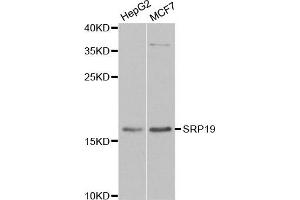 Western blot analysis of extracts of various cell lines, using SRP19 antibody. (SRP19 antibody)