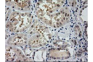 Immunohistochemical staining of paraffin-embedded Human Kidney tissue using anti-GSS mouse monoclonal antibody. (Glutathione Synthetase antibody)