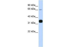 Troponin T Type 1 antibody used at 1 ug/ml to detect target protein. (TNNT1 antibody)
