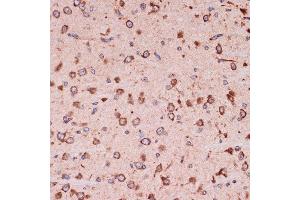 Immunohistochemistry of paraffin-embedded mouse brain using Peroxiredoxin 4 (PRDX4) (PRDX4) Rabbit mAb (ABIN7269238) at dilution of 1:100 (40x lens). (Peroxiredoxin 4 antibody)