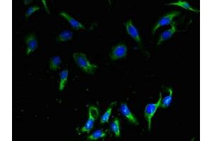 Immunofluorescent analysis of Hela cells using ABIN7147809 at dilution of 1:100 and Alexa Fluor 488-congugated AffiniPure Goat Anti-Rabbit IgG(H+L) (CMTM2 antibody  (AA 1-80))