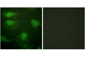 Immunofluorescence analysis of HeLa cells, using CaMK1-alpha (Phospho-Thr177) Antibody. (CAMK1 antibody  (pThr177))