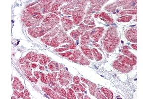 Anti-NANOS1 antibody IHC of human heart. (Nanos Homolog 1 antibody  (AA 50-100))