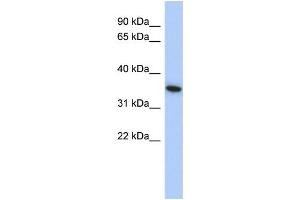 WB Suggested Anti-MXI1 Antibody Titration: 0. (MXI1 antibody  (Middle Region))
