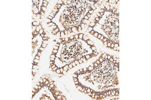 Immunohistochemical analysis of paraffin-embedded human small intestine tissue using (ABIN656961 and ABIN2846145) performed on the Leica® BOND RXm. (CLMP antibody  (AA 81-110))