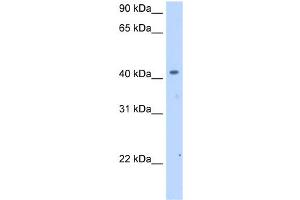 WB Suggested Anti-SLC25A24 Antibody Titration:  2. (SLC25A24 antibody  (Middle Region))