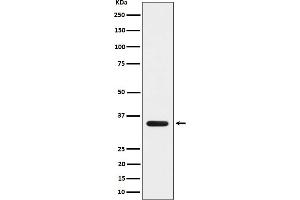 Western blot analysis of MLD expression in 293 cell lysate. (Recombinant MBP antibody)