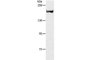 Western Blot analysis of Mouse kidney tissue using ACE1 Polyclonal Antibody at dilution of 1:1000 (Angiotensin I Converting Enzyme 1 antibody)