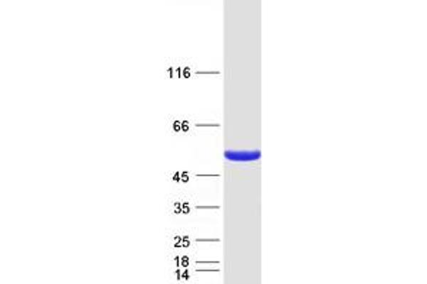 DBT Protein (Myc-DYKDDDDK Tag)