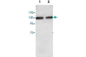 Western blot analysis of HUVEC cell (Lane 1) and human placenta (Lane 2) lysate with RBBP6 polyclonal antibody  at 1 : 1000 dilution. (RBBP6 antibody  (Internal Region))