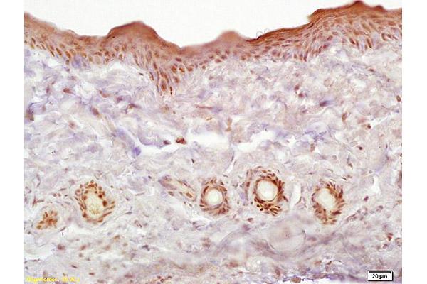 LGALS7 antibody  (AA 31-100)