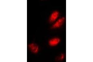 Immunofluorescent analysis of ASF1A staining in A549 cells. (ASF1A antibody)