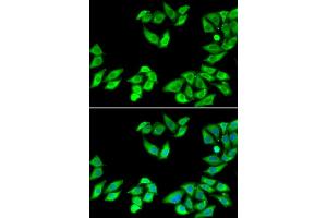 Immunofluorescence analysis of MCF7 cell using RPS14 antibody. (RPS14 antibody)