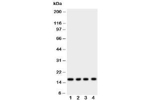 Western blot testing of Myoglobin antibody and rat samples 1: skeletal muscle (Myoglobin antibody  (AA 138-154))