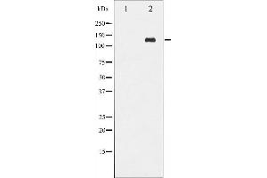 Western Blotting (WB) image for anti-C-Abl Oncogene 1, Non-Receptor tyrosine Kinase (ABL1) (pTyr412) antibody (ABIN6255911)
