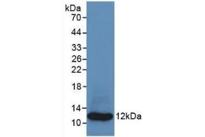 Detection of Recombinant S100A8, Human using Monoclonal Antibody to S100 Calcium Binding Protein A8 (S100A8) (S100A8 antibody  (AA 1-93))